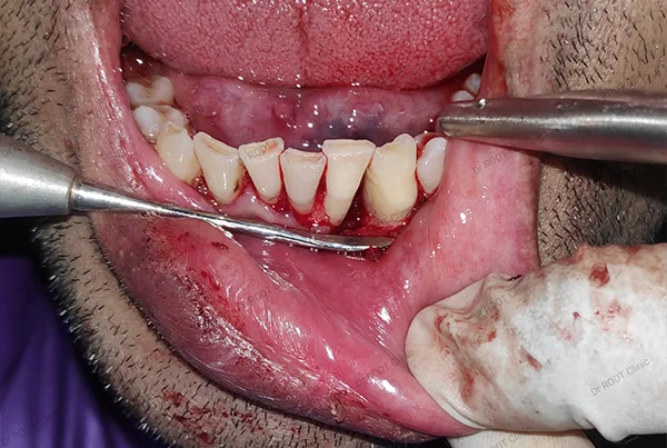 Dental Treatments