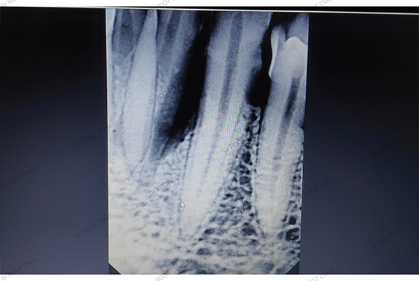 Dental Treatments