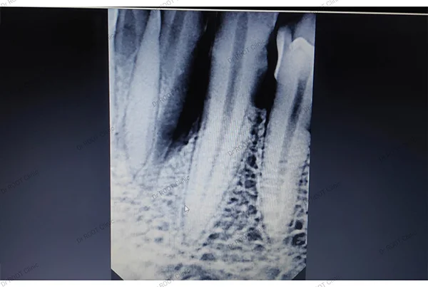 Dental Treatments