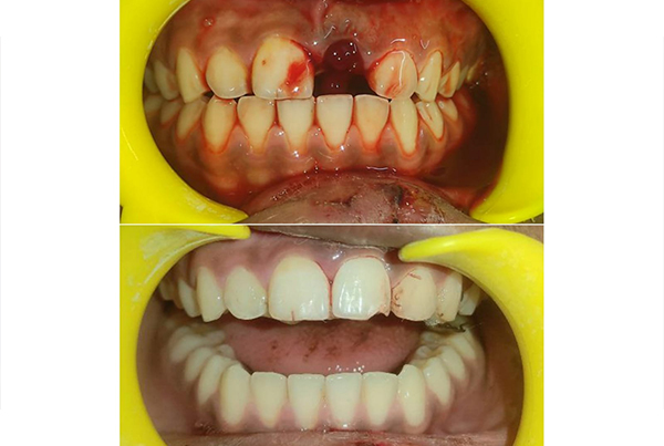 Dental Treatments