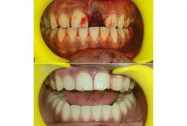 Dental Treatments
