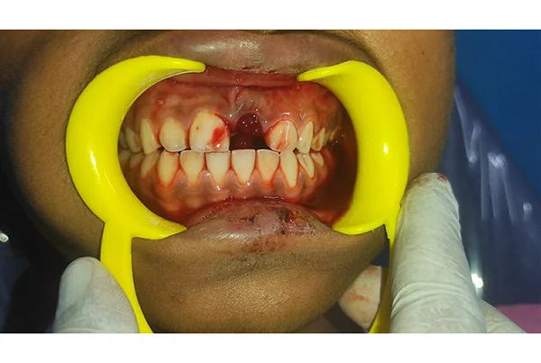 Dental Treatments