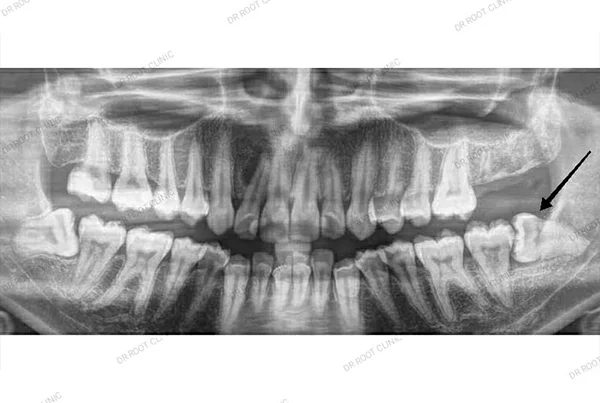 Dental Treatments