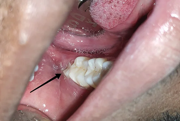 Dental Treatments