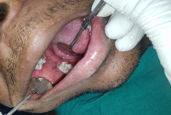 Dental Treatments