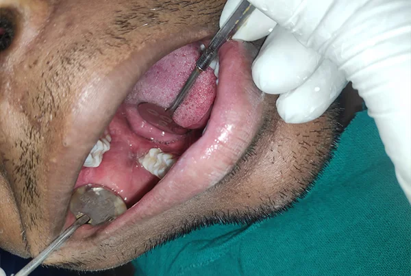 Dental Treatments