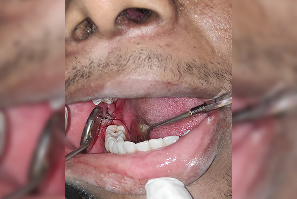 Dental Treatments