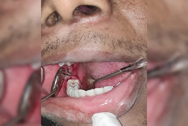 Dental Treatments