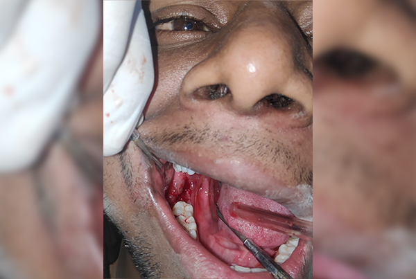 Dental Treatments