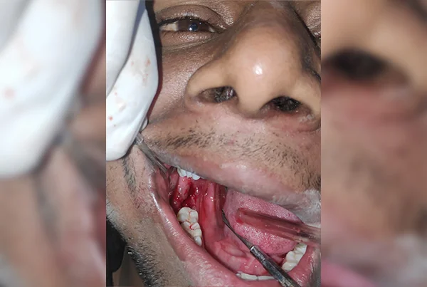 Dental Treatments