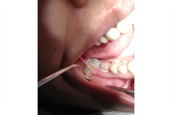 Dental Treatments