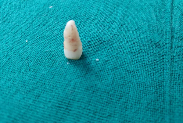 Dental Treatments