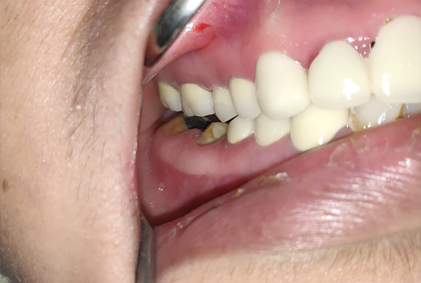 Dental Treatments