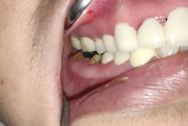 Dental Treatments