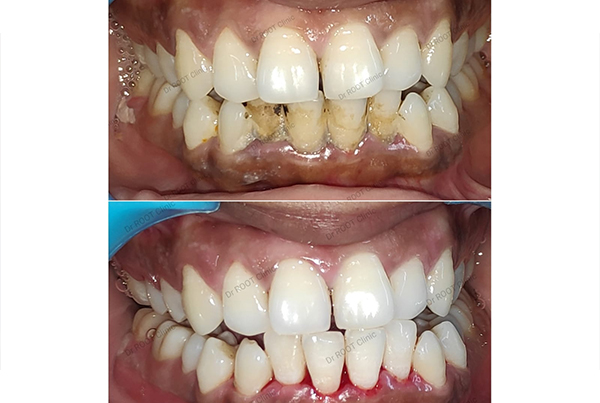 Dental Treatments