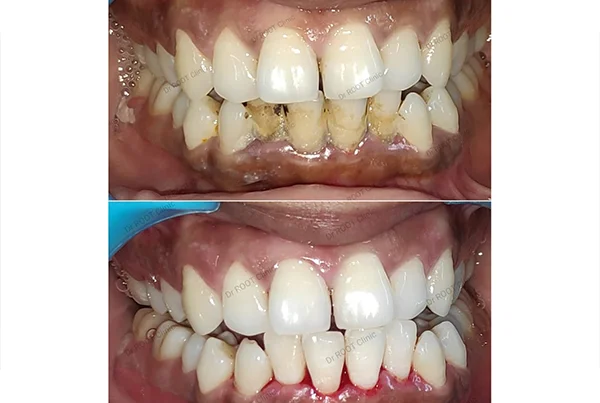 Dental Treatments