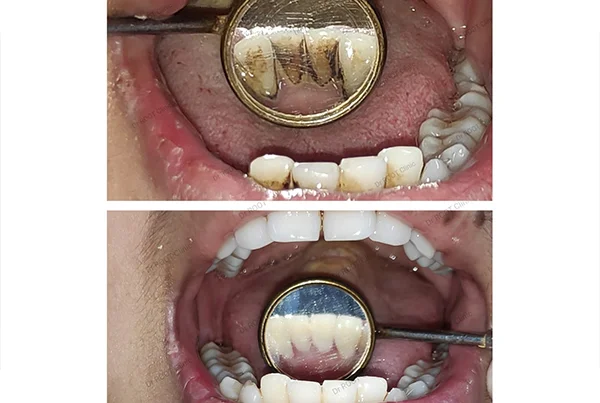 Dental Treatments