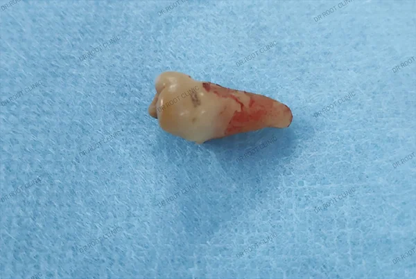 Dental Treatments
