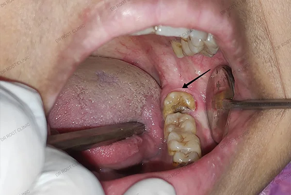 Dental Treatments