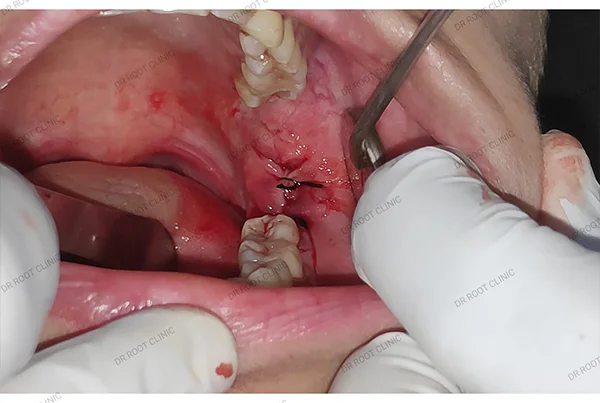 Dental Treatments