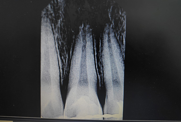 Dental Treatments
