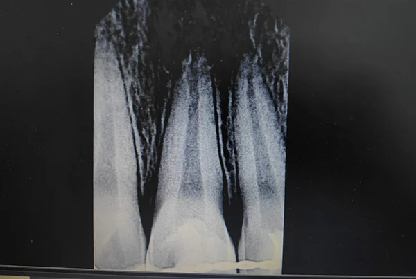 Dental Treatments
