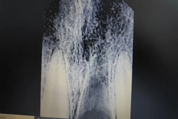 Dental Treatments