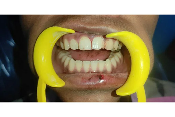 Dental Treatments