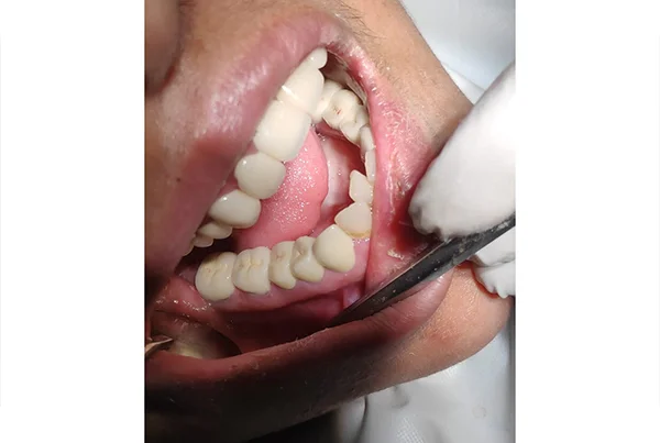Dental Treatments