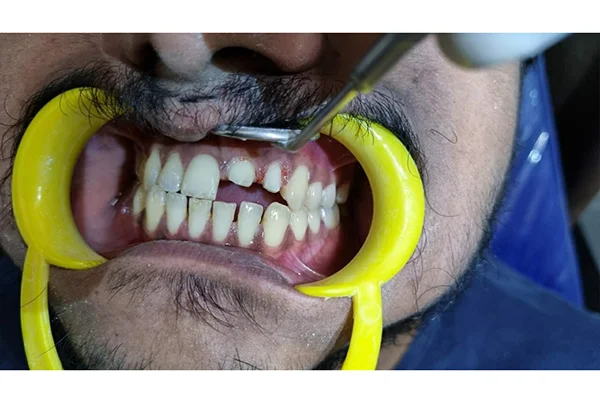 Dental Treatments