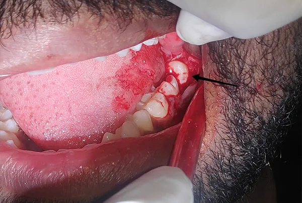 Dental Treatments