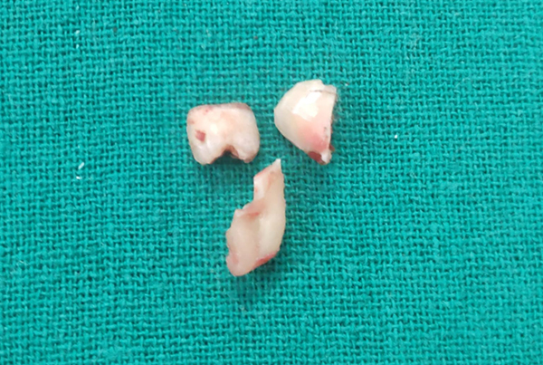 Dental Treatments