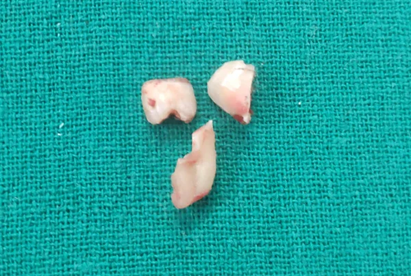 Dental Treatments