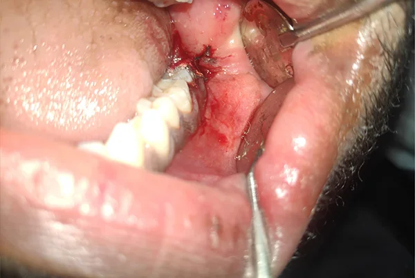 Dental Treatments