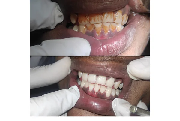 Dental Treatments
