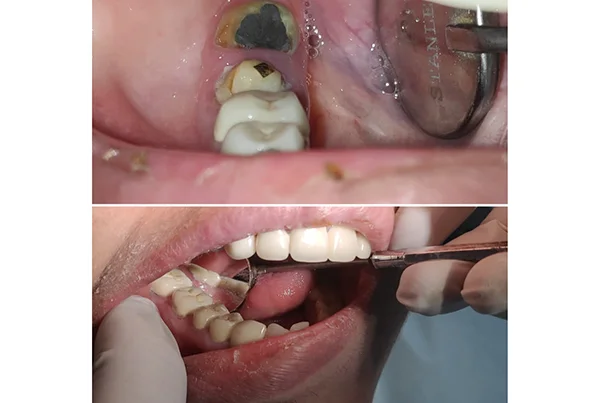 Dental Treatments