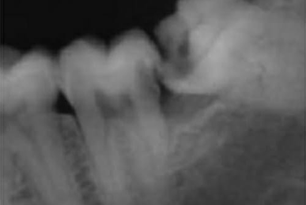 Dental Treatments