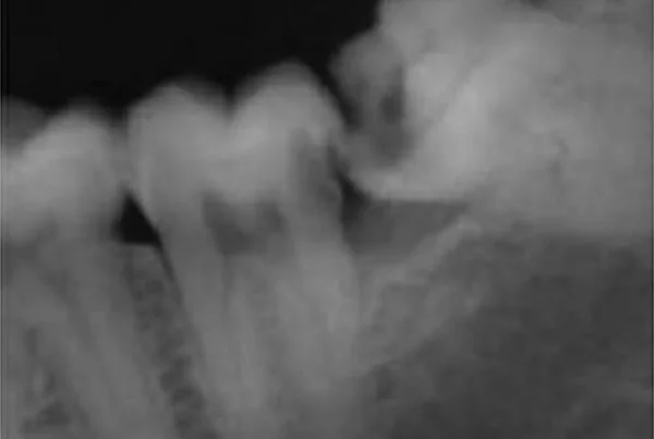Dental Treatments