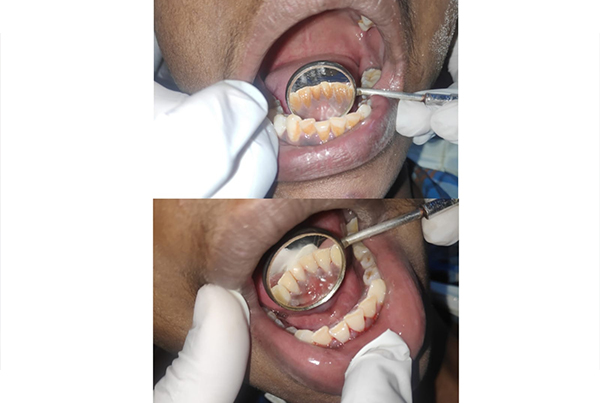 Dental Treatments