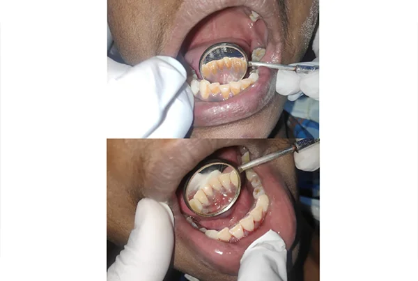 Dental Treatments