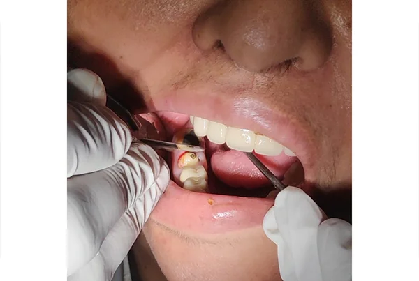 Dental Treatments