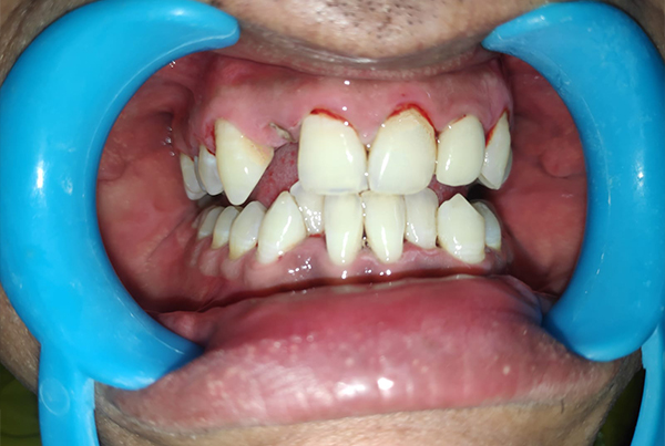 Dental Treatments