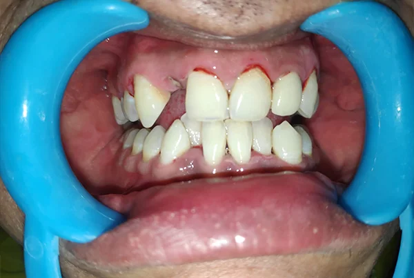 Dental Treatments