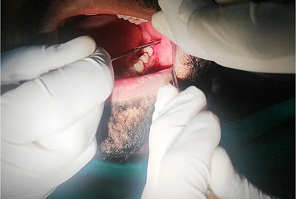 Dental Treatments