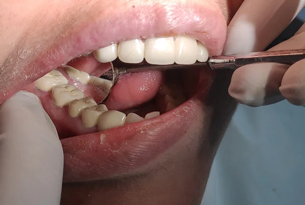 Dental Treatments