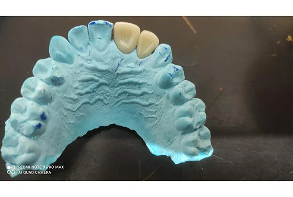 Dental Treatments