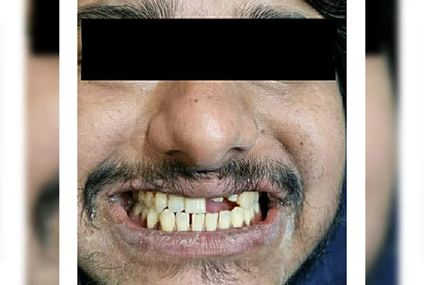 Dental Treatments