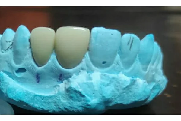 Dental Treatments