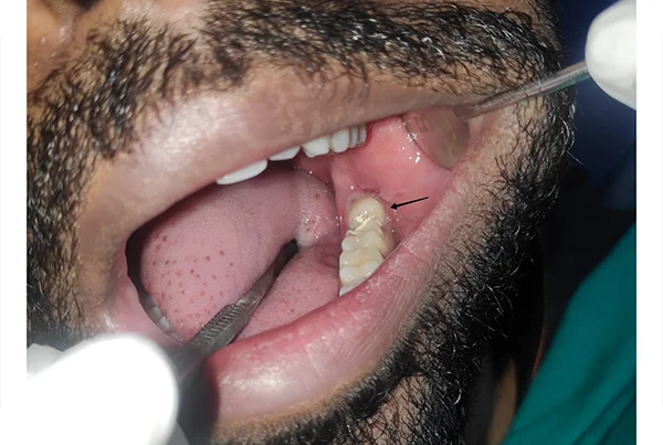 Dental Treatments