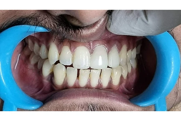 Dental Treatments